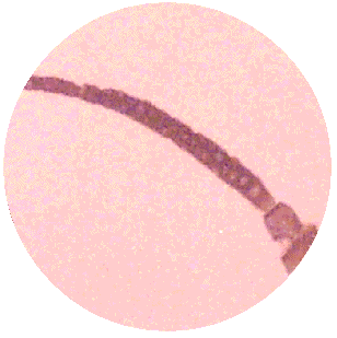 APHID ANTENNA