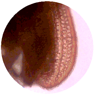 LYCID WINGCASE